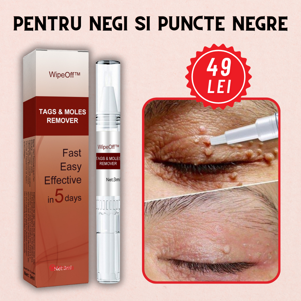 Solutie Pentru indepartarea Negilor si a Petelor Pigmentate