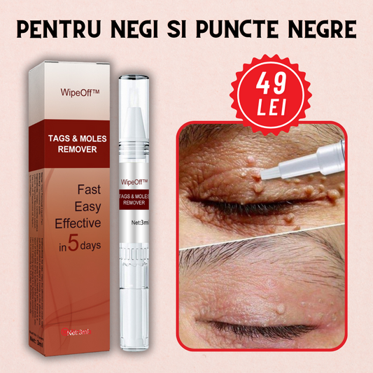Solutie Pentru indepartarea Negilor si a Petelor Pigmentate